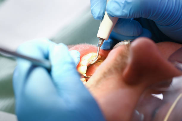 Best Broken Tooth Emergency  in Lena, IL