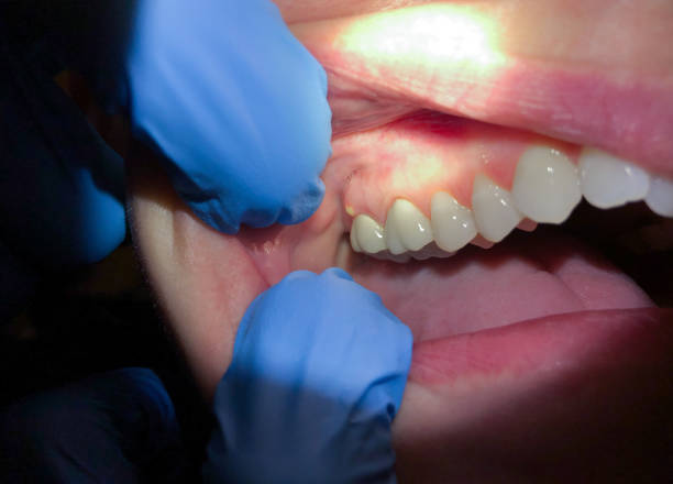 Best Broken Tooth Emergency  in Lena, IL
