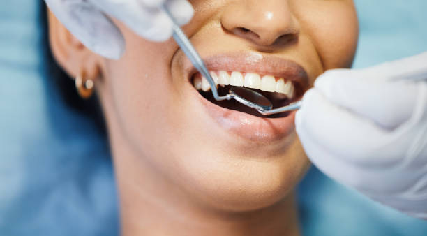 Emergency Dentist for Kids in IL